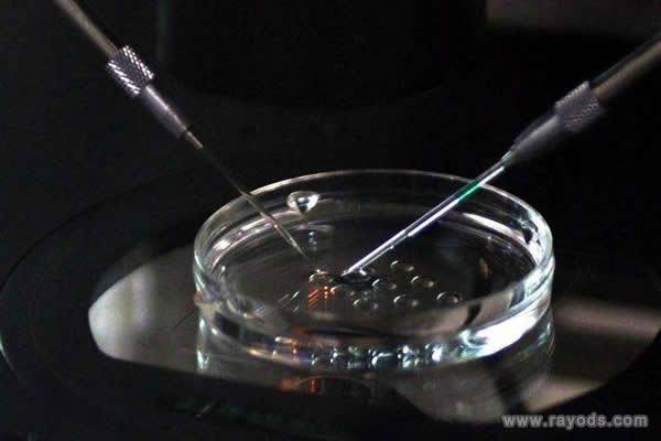 完整版本的做试管婴儿流程