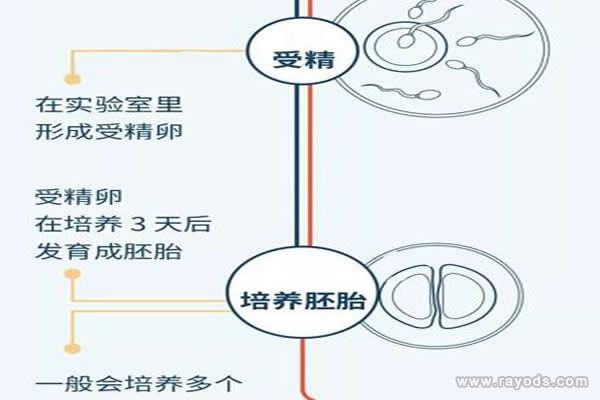 试管婴儿的步骤过程详细图解