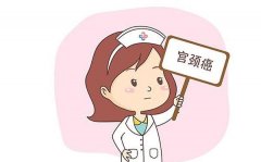 tct检查时间如何选择,如何确定检查时间间隔
