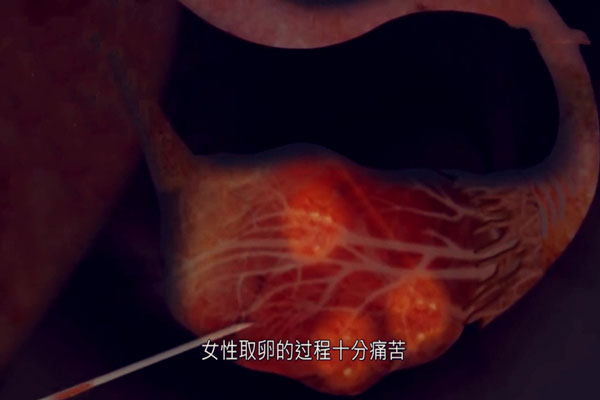3D模拟图告诉你做试管婴儿疼吗