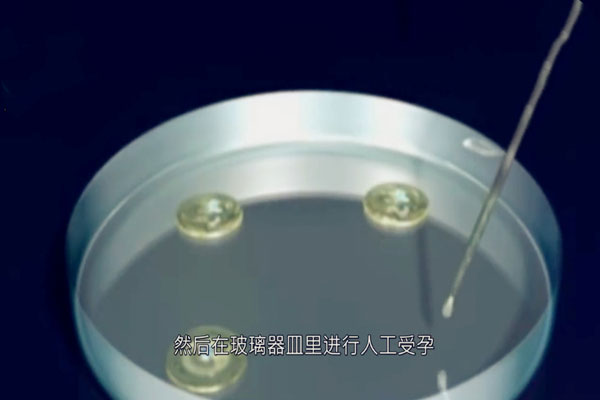3D模拟图告诉你做试管婴儿疼吗