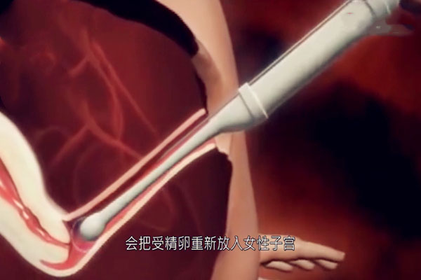 3D模拟图告诉你做试管婴儿疼吗