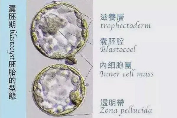 胚胎质量等级怎么区分