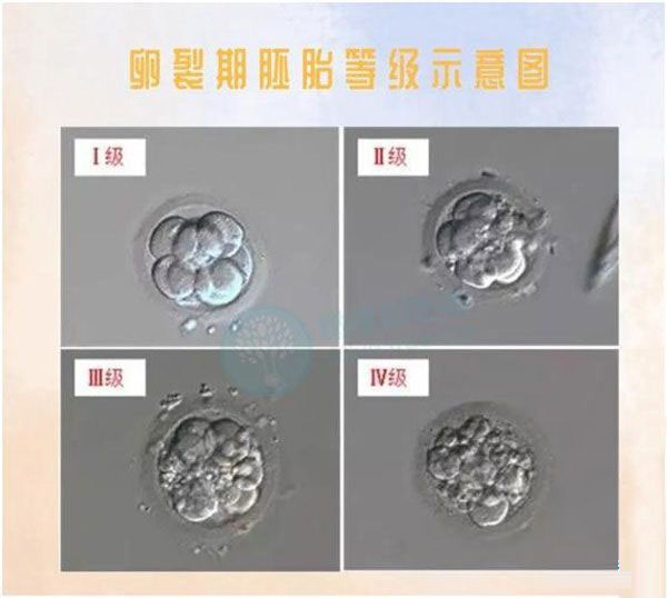 胚胎质量等级怎么区分