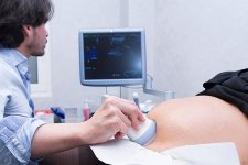 16周女宝清晰B超图分享：三条线、凸起、字母是明显特征
