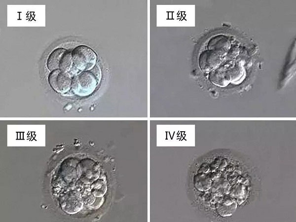 胚胎等级