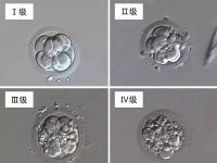 试管三级胚胎移植成功案例分享：经验告诉你心态很重要！