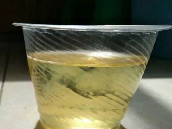 酒精加晨尿测男女