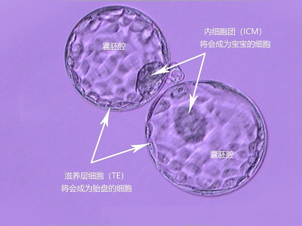 融合胚胎和囊胚哪个成功率高