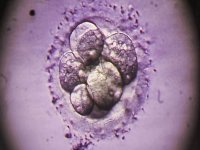 移植4bc囊胚成功经验分享：第二天最关键做好这些着床不难
