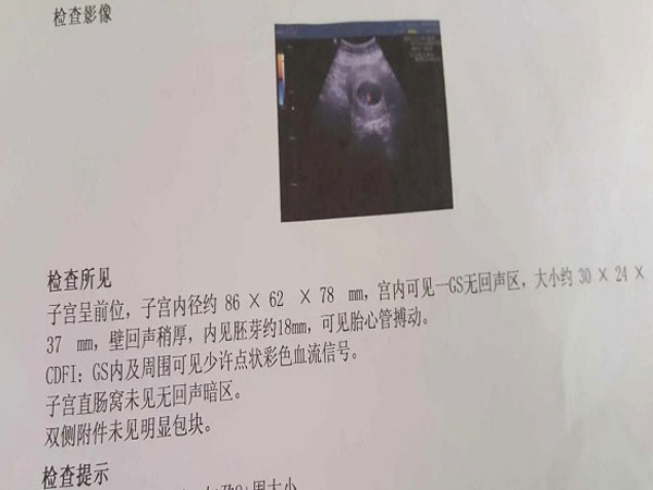 卵黄囊及胚芽孕周对照表