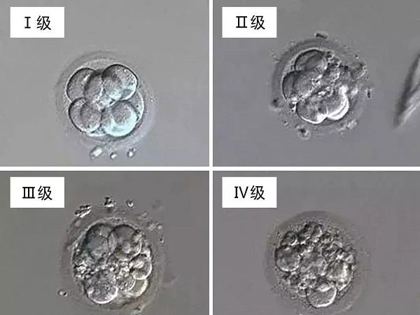 胚胎等级