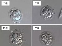 试管b级胚胎质量好不好?A级、B级、C级和D级对照表一览