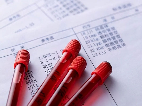 amh主要是由女性的卵巢进行分泌的