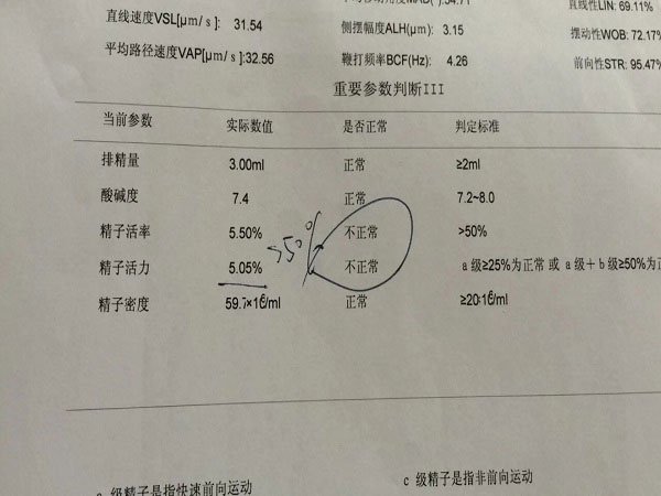 精子DNA碎片率是检查报告中的一个指标