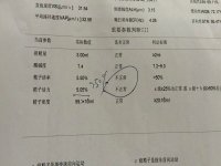 dna碎片率高做第几代试管婴儿？做那第几代看完便知