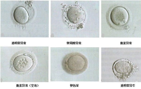 卵泡发育异常的种类一览