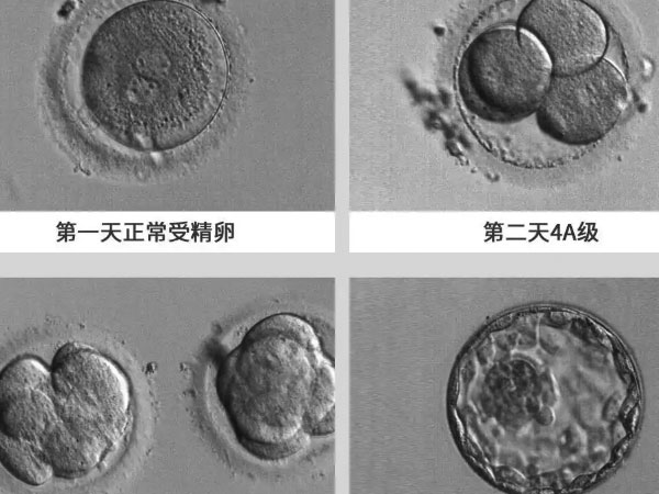 养囊一般是5-7天出结果
