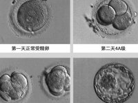 养囊第三天没出结果别着急，5细胞也有希望养成功