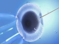 试管婴儿如何定方案?什么时候制定看完就知道