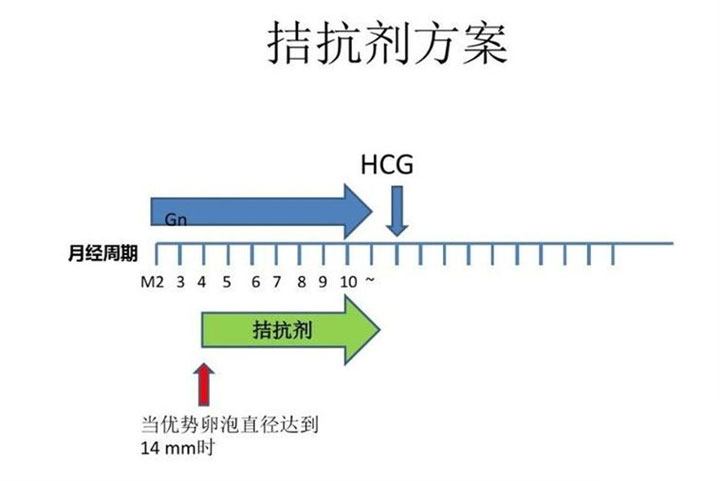 拮抗剂方案 