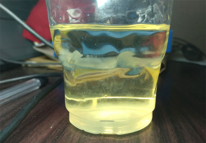 小便颜色